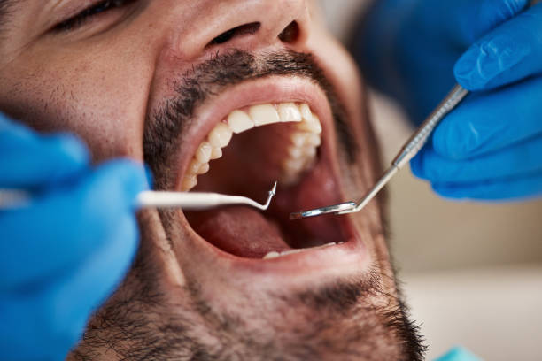 Best Emergency Dental Care for Abscessed Tooth in Island Heights, NJ
